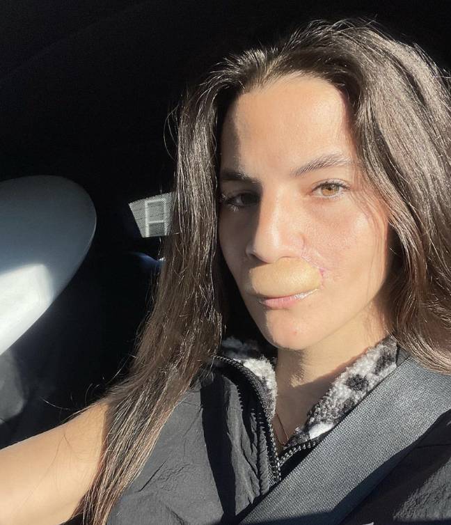 Brooklinn Khoury Says Her Lip Was Thrown 'in the Trash' After Dog Attack
