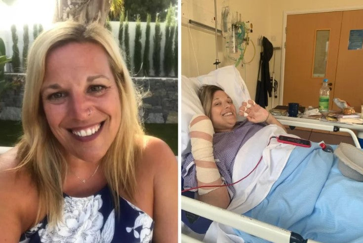 Woman diagnosed with sepsis ends up in hospital for seven months - symptoms and how it's treated